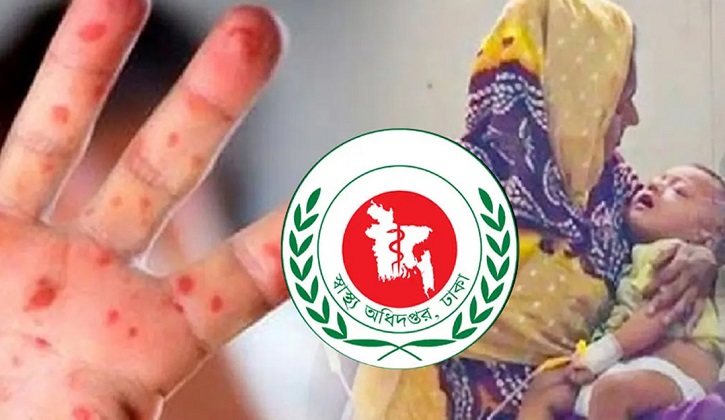সিলেট বিভাগে হাম উপসর্গ নিয়ে প্রাণ গেল ৫ শিশুর
