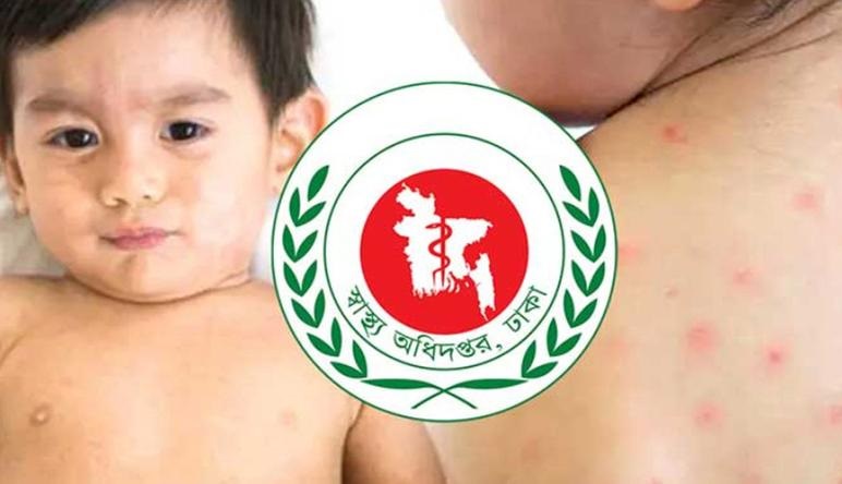 হাম ও উপসর্গ নিয়ে প্রাণ গেল আরও ১১ শিশুর