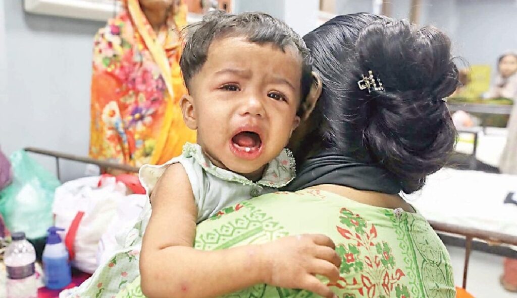 দেশে হাম ও উপসর্গে নিয়ে প্রাণ গেল আরও ১৭ শিশুর