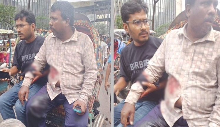 মতিঝিলে প্রকাশ্যে ব্যবসায়ীকে গুলি করে ১৭ হাজার ডলার লুট