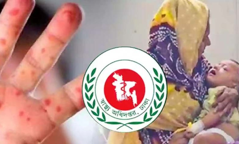 দেশে হামের উপসর্গে প্রাণ গেল আরও ৮ শিশুর